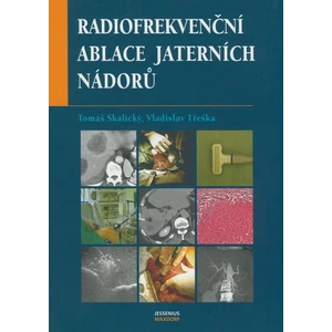 Radiofrekvenční ablace jaterních nádorů - Vladislav Třeška, Tomáš Skalický