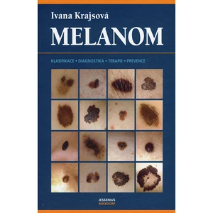 Melanom - Krajsová Ivana