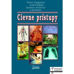 Cievne prístupy