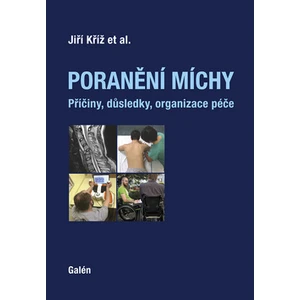 Poranění míchy -- Příčiny, důsledky, organizace péče