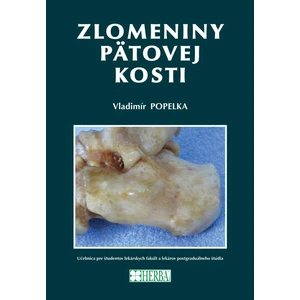 Zlomeniny pätovej kosti - Popelka Vladimír