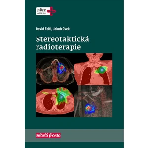 Stereotaktická radioterapie - Feltl David, Cvek Jakub