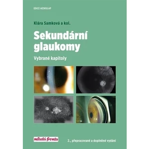 Sekundární glaukomy - Klára A. Samková