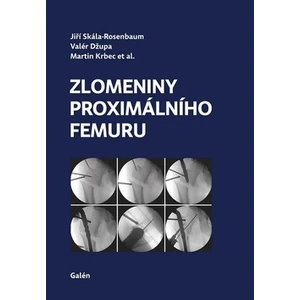 Zlomeniny proximálního femuru