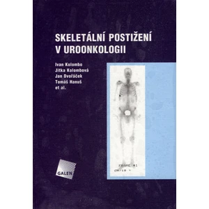 Skeletální postižení v uroonkologii