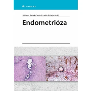 Endometrióza - Lenz Jiří, Chvátal Radek, Fiala Luděk