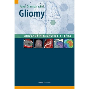 Gliomy - současná diagnostika a léčba - Šlampa Pavel