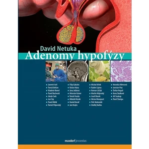 Adenomy hypofýzy - Netuka David