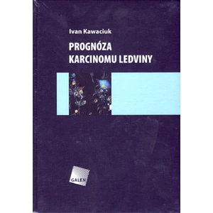 Prognóza karcinomu ledviny - Kawaciuk Ivan