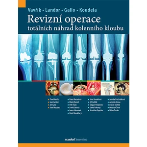 Revizní operace totálních náhrad kolenního kloubu - Pavel Vavřík, Gallo Jiří, Ivan Landor