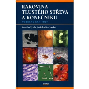 Rakovina tlustého střeva a konečníku