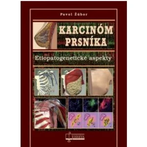 Karcinóm prsníka -- Etiopatogenetické aspekty - Žúbor Pavol