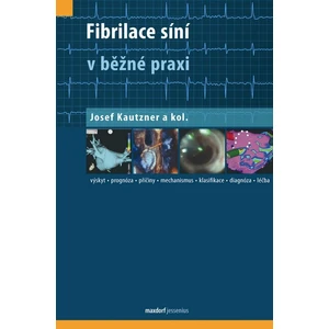 Fibrilace síní v běžné praxi