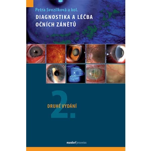Diagnostika a léčba očních zánětů - Svozílková Petra