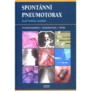 Spontánní pneumotorax -- Etiopatogeneze, diagnostika, léčba