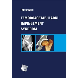 Femoroacetabulární impingement syndrom - Petr Chládek