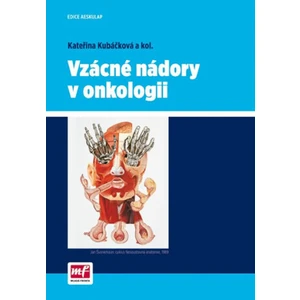 Vzácné nádory v onkologii - Kubáčková Kateřina